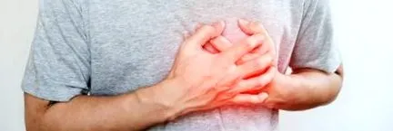 синдром