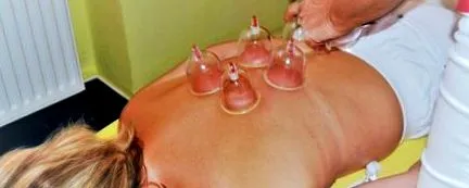 masaj cupping masaj cupping
