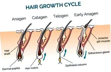 hirsutism