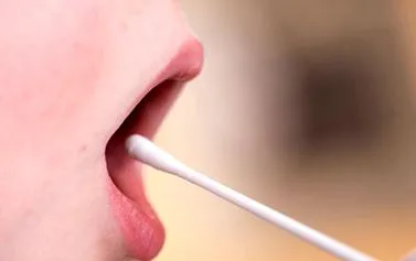 mucosal