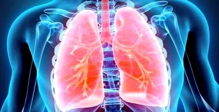 copd