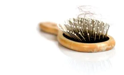 alopecia