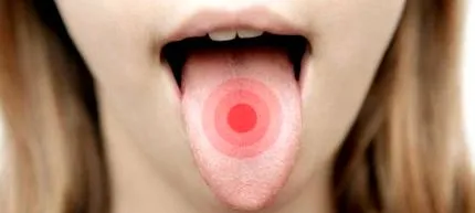 язика