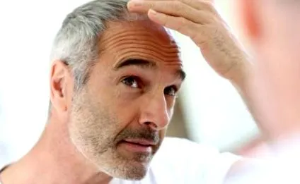 загуба коса