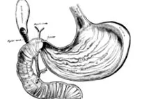 biliari