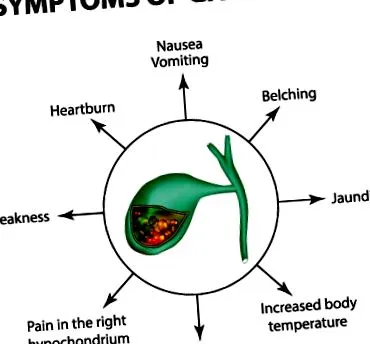 ileus