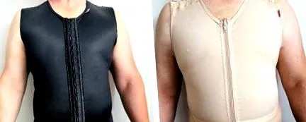 eltávolította