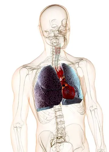 pulmonar
