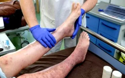 válik