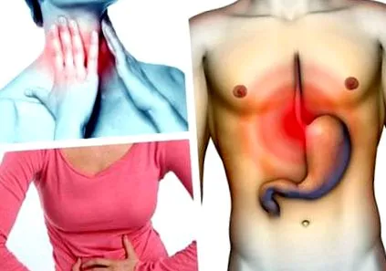 oesophagitis