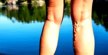 gimnastica