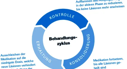 roche terápiája