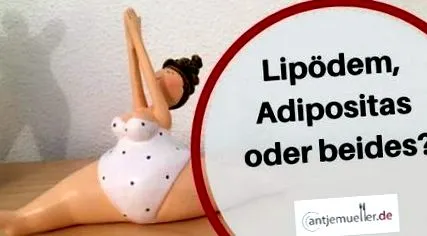 lipedema