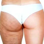 kezelés