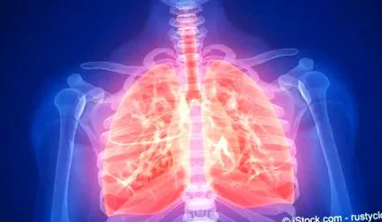 pulmonale третман