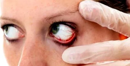 ochii googly