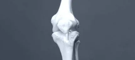 knie knie