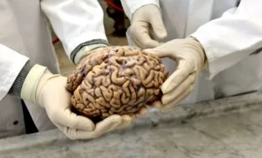 neuropatologie