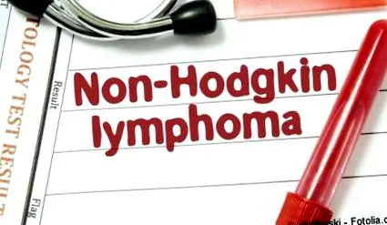 non-hodgkin