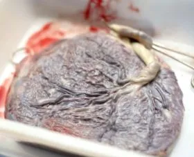 placenta