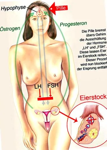 дефіциту прогестерону