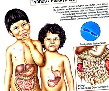 okai tünetei paratyphoid