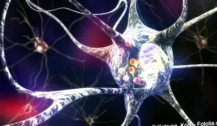 parkinson