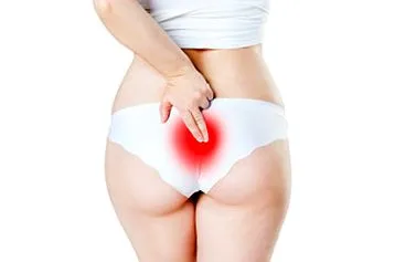 pilonidal