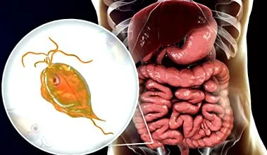transmitere trichomonas