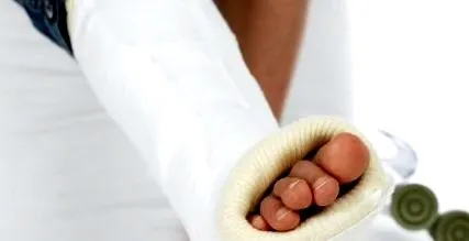fractură compresie