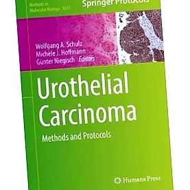 carcinoma
