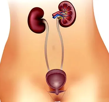 cistocele