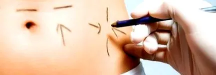 diako