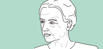 facelift