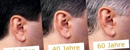auditivă