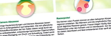 klasszikus