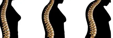 pentru osteoporoză