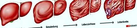 detoxifiere detoxifiere