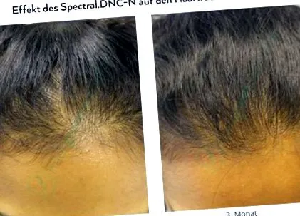 dnc-n
