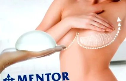 mellimplantátumok mentor
