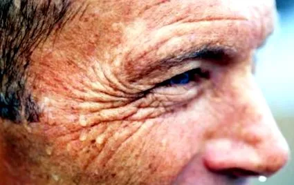 izzadás verít
