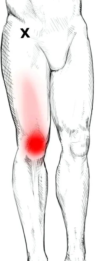 quadriceps