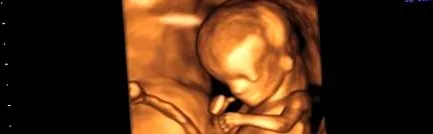 genetika prenatális