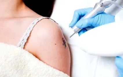tatuajelor