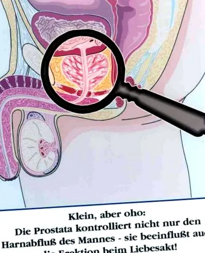 fügekaktusz kivonatok