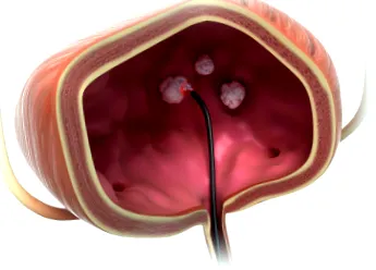 biolitec