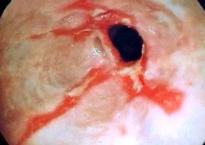 terapia