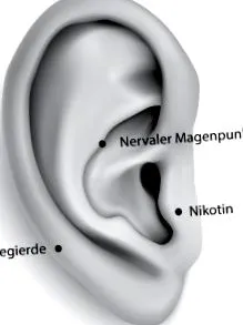 acupunctura urechii