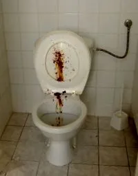 ступедидија