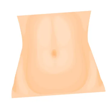 liposucție liposucție